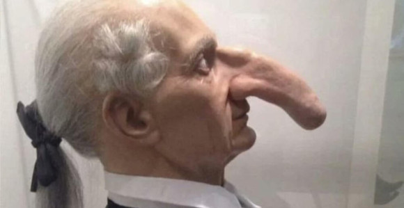 Imao je najveći nos na svetu dugačak čak 19 centimetara!