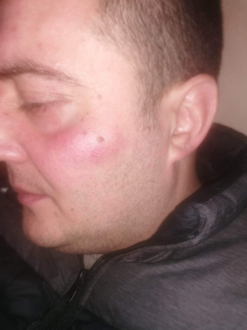 U pesničenju učestvovao i direktor Pošta