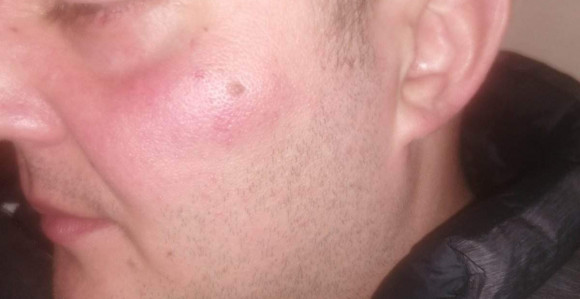 U pesničenju učestvovao i direktor Pošta