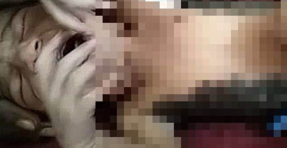 Tek rođenoj bebi pola tela prekriveno gustom crnom dlakom! (VIDEO)