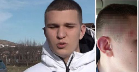 Uhapšen Albanac koji je pretukao dječaka (15)