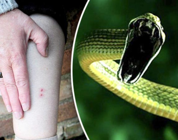 Zabilježen prvi slučaj ugriza zmije ove godine u Srpskoj