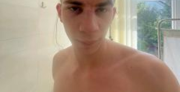 Fizički obračun vlasnika i gosta u kafiću u Zvorniku
