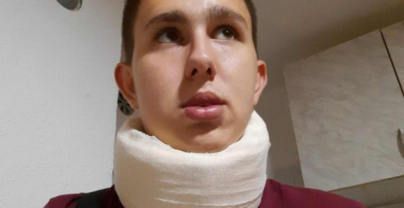 Brutalno pretučen bošnjački mladić u Bratuncu