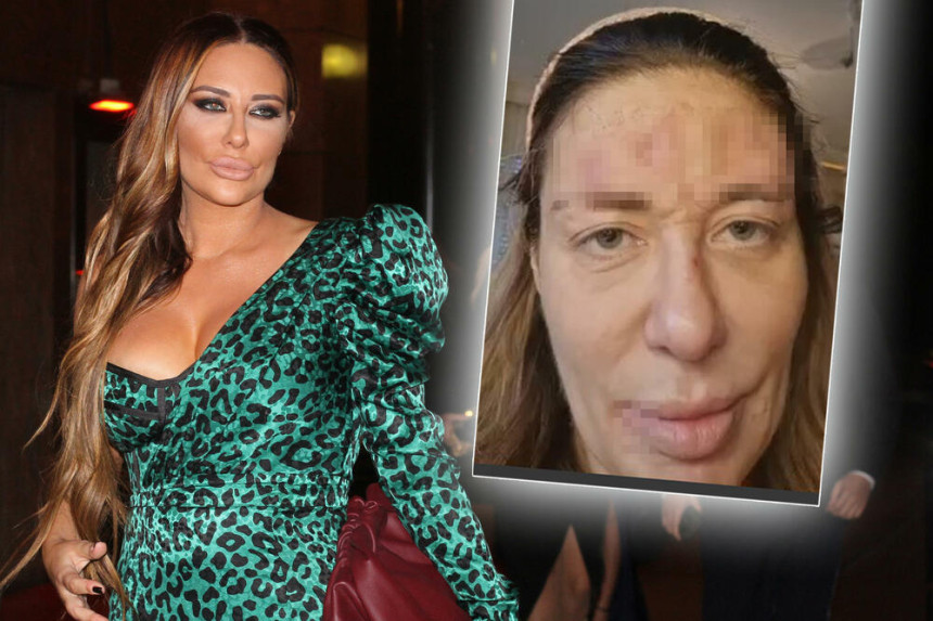 Prvo javno obraćanje Ane Nikolić posle skandala: Nikada nisam probala drogu!