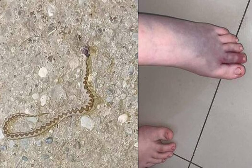 Djevojčicu (12) ugrizao poskok kod Zvornika