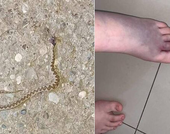 Djevojčicu (12) ugrizao poskok kod Zvornika