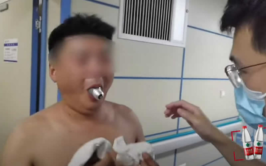 Zbog onlajn izazova zaglavio sijalicu u ustima!