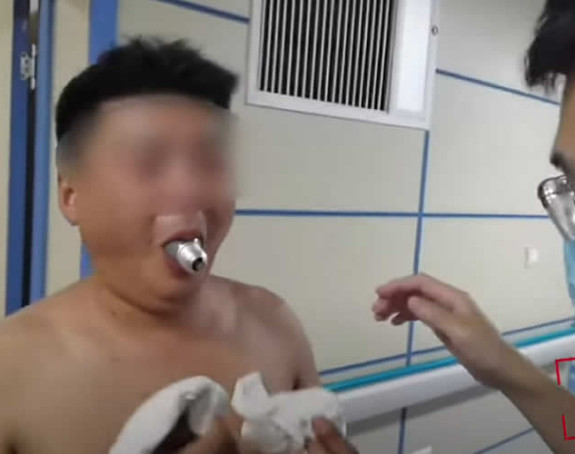 Zbog onlajn izazova zaglavio sijalicu u ustima!