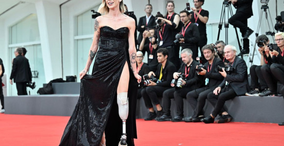 Heroina Venecije: Svi imamo svoj oblik ljepote