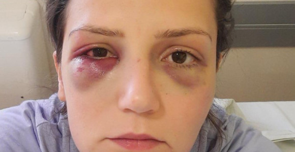 Počinje suđenje vlasniku hotela za napad na radnicu