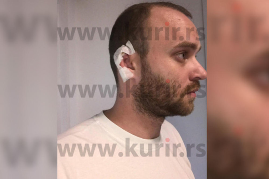 Pevaču na nastupu gost odgizao uvo!