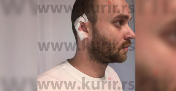 Pevaču na nastupu gost odgizao uvo!