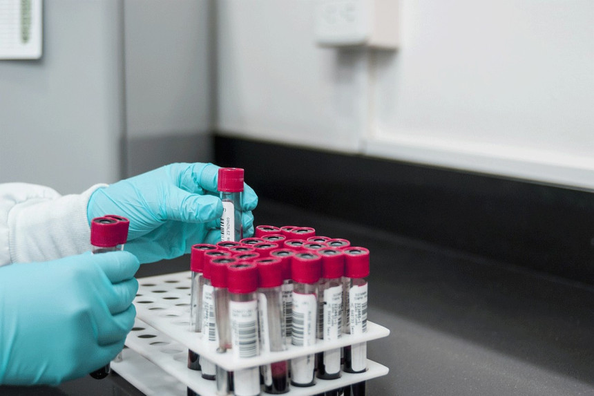 Djeca dobijala krv zaraženu HIV-om i hepatitisom