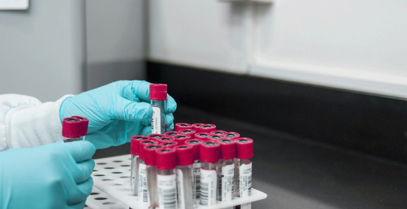 Djeca dobijala krv zaraženu HIV-om i hepatitisom