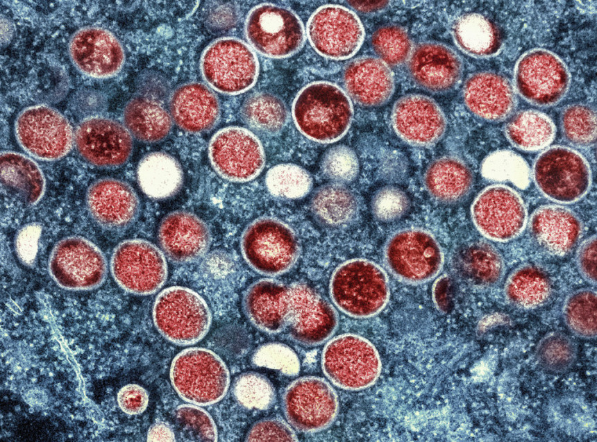 Потврђен први случај мајмунских богиња у Шведској