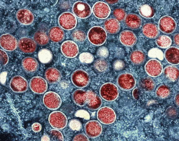 Потврђен први случај мајмунских богиња у Шведској