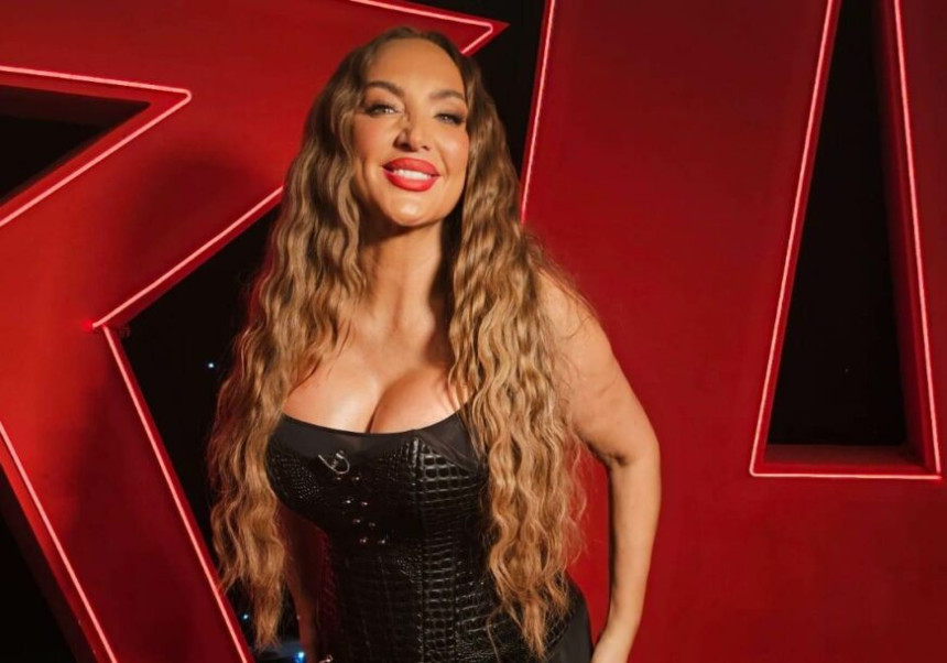 Pjevačicu Gogu Sekulić udario automobil