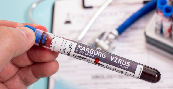 Sumnja se da je smrtonosni virus stigao u Evropu