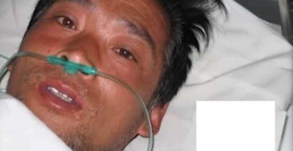 Čovjek koji je umro najbolnijom smrću ikad