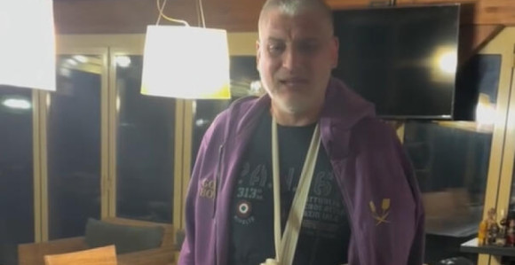 Čeda Jovanović otkrio ko mu je polomio ruku!