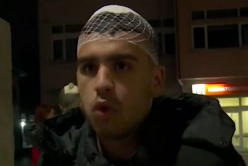 "Imam kopče na glavi i potres mozga" (VIDEO)