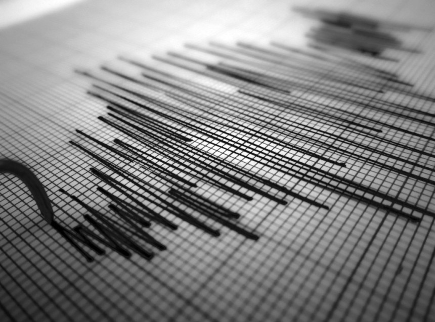 У Истанбулу је хоспитализована 151 особа