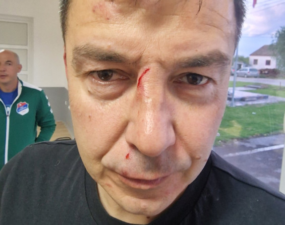 Trojica uhapšena zbog napada na glavnog sudiju