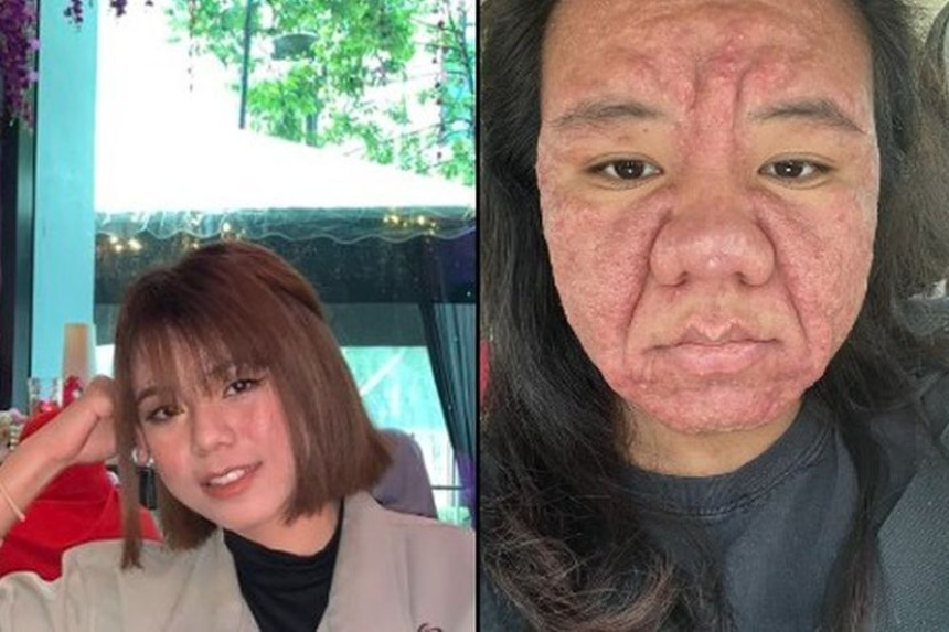 Trudnoća pretvorila mladu djevojku u staricu (VIDEO)