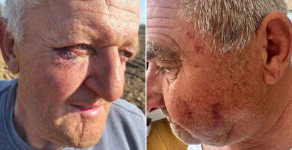 Banjaluka: Policijska brutalnost nad penzionerima?!