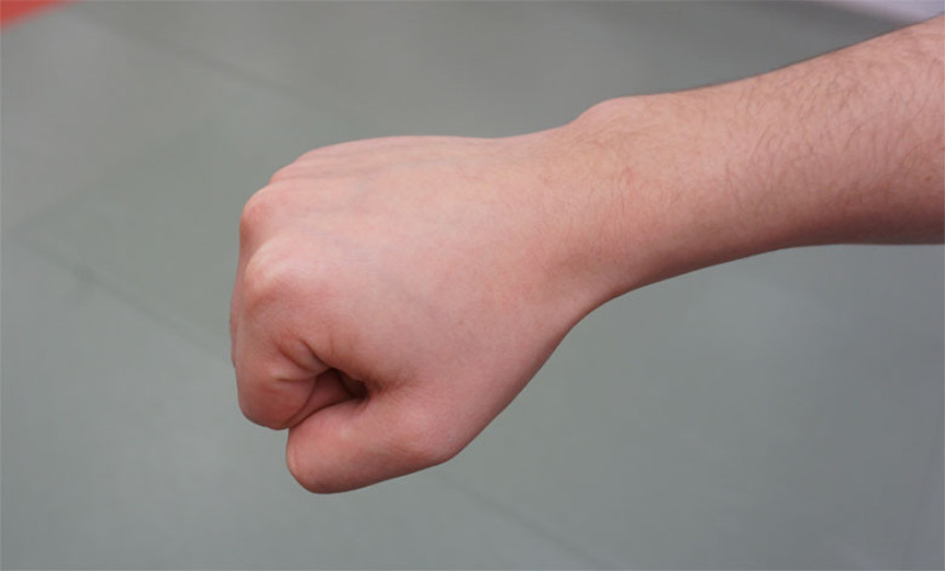 Mladića uvukli u kombi i izgrizli