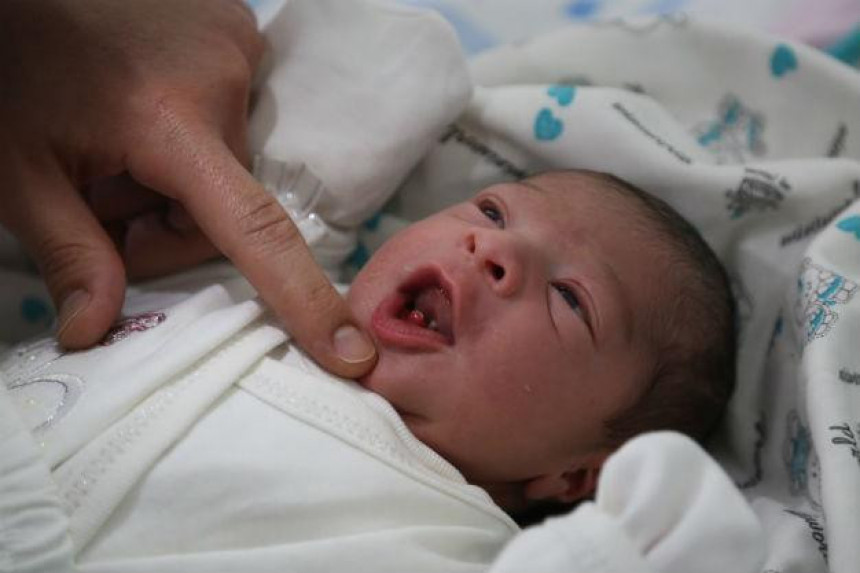 У Бијељини рођена беба са два предња зуба