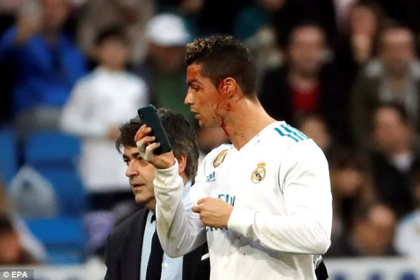 Ronaldo zaradio 3 kopče i "šljivu", ne igra u kupu!