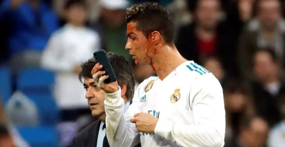 Ronaldo zaradio 3 kopče i "šljivu", ne igra u kupu!