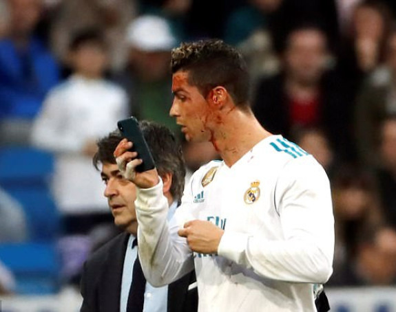Ronaldo zaradio 3 kopče i "šljivu", ne igra u kupu!