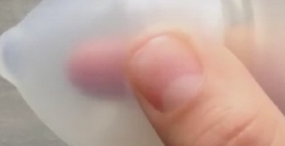 Kondomi će imati električne vodove