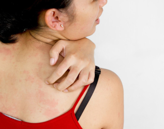 Svrab je simptom mnogih bolesti