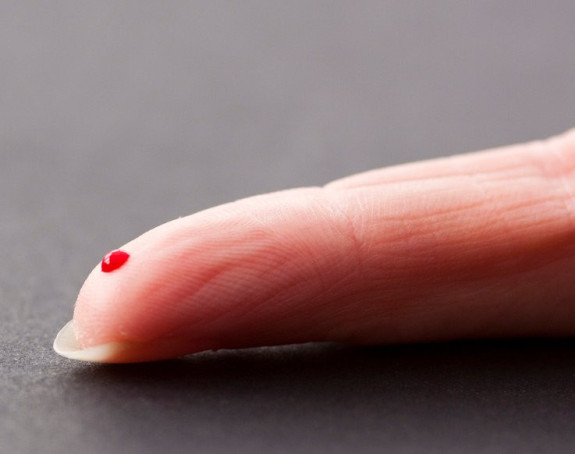 Krvnu grupu A pretvorili u 0!