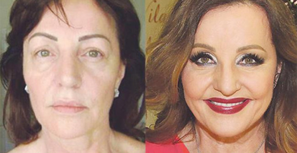 Borba: Ana Bekuta stalni klijent plastičara