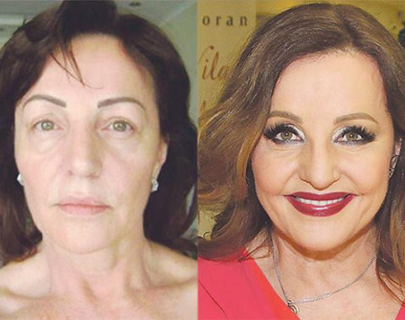 Borba: Ana Bekuta stalni klijent plastičara