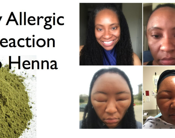 Zašto bojenje kose kanom može biti opasno