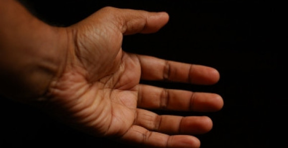 Odsjekla ruku i nogu da prevari osiguranje