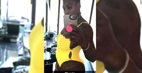 Serena Vilijams slučajno objavila da je trudna