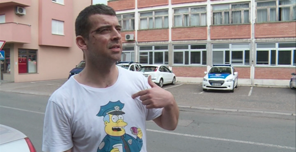  Policija me istukla jer sam tražio značku