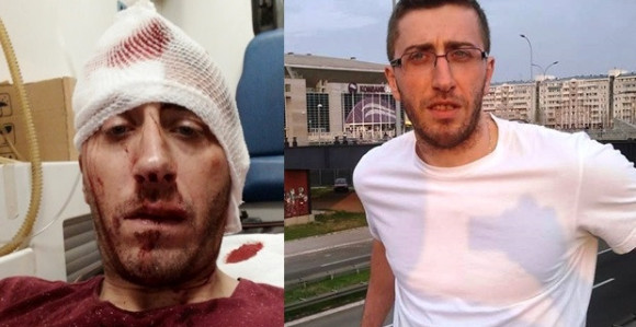 Izvještaj zbog pokušaja ubistva