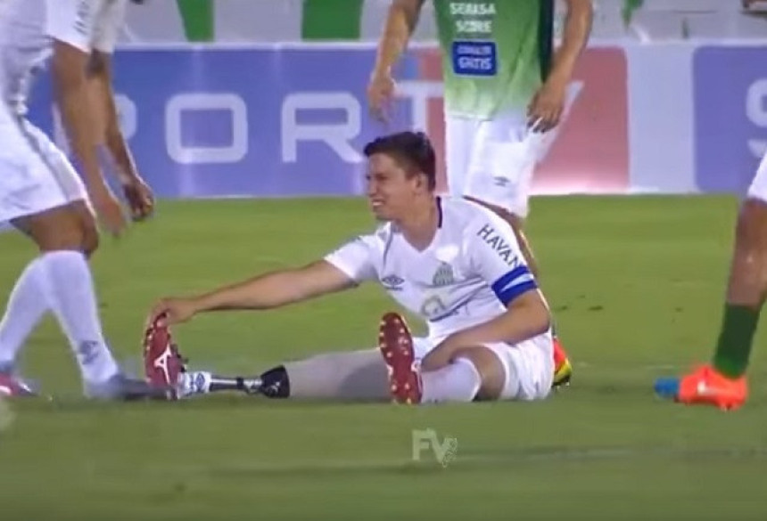 Video: Grč u nozi... Samo, nema noge!