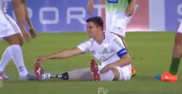 Video: Grč u nozi... Samo, nema noge!