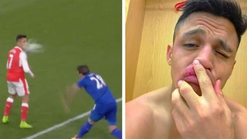 Aleksis, nisi za ovo dobio radnu dozvolu!