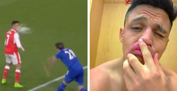 Aleksis, nisi za ovo dobio radnu dozvolu!