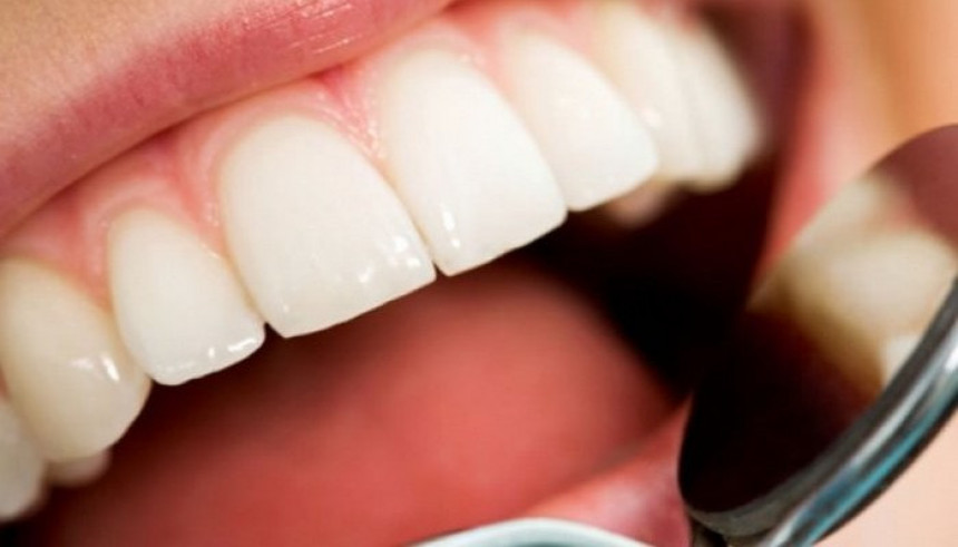 10 навика које оштећују зубе
